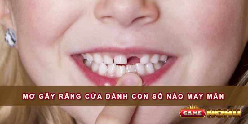 Mơ gãy răng cửa đánh con số nào may mắn?